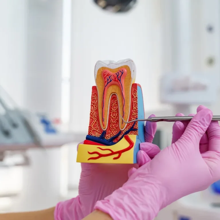 root-canal-treatment